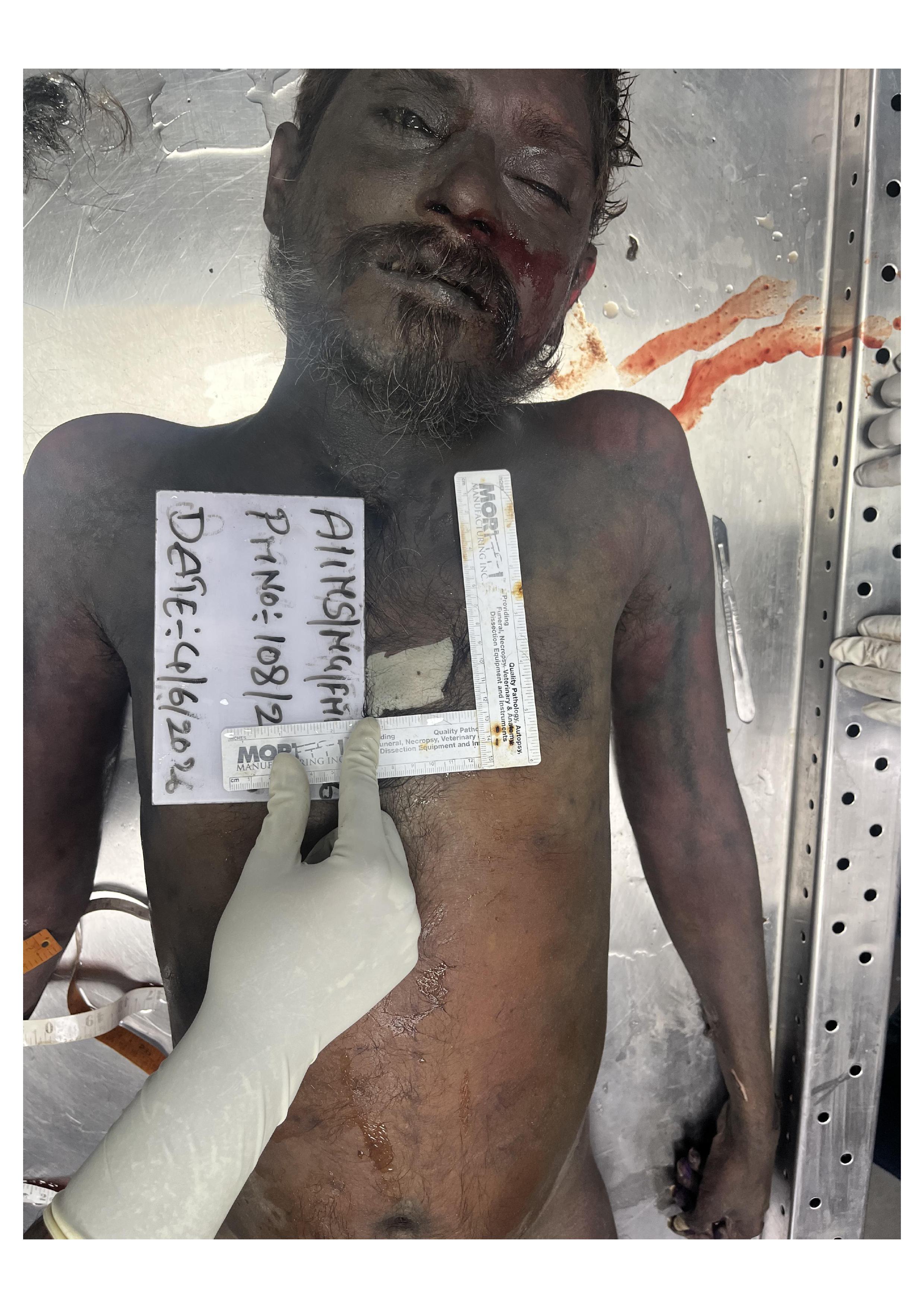 Front Image