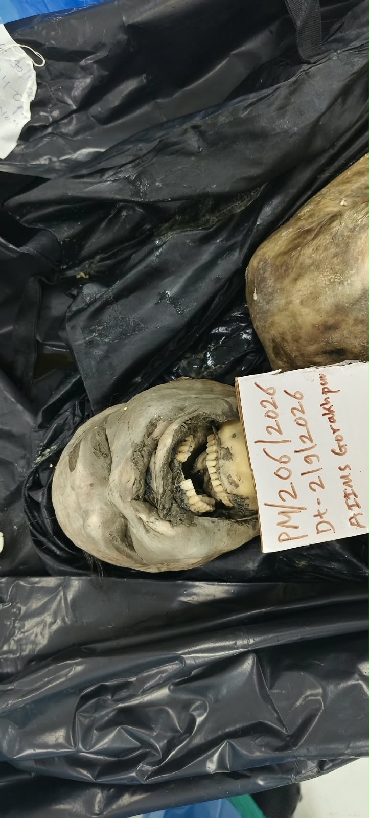 Front Image