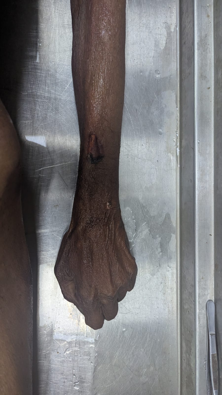 Scar Image