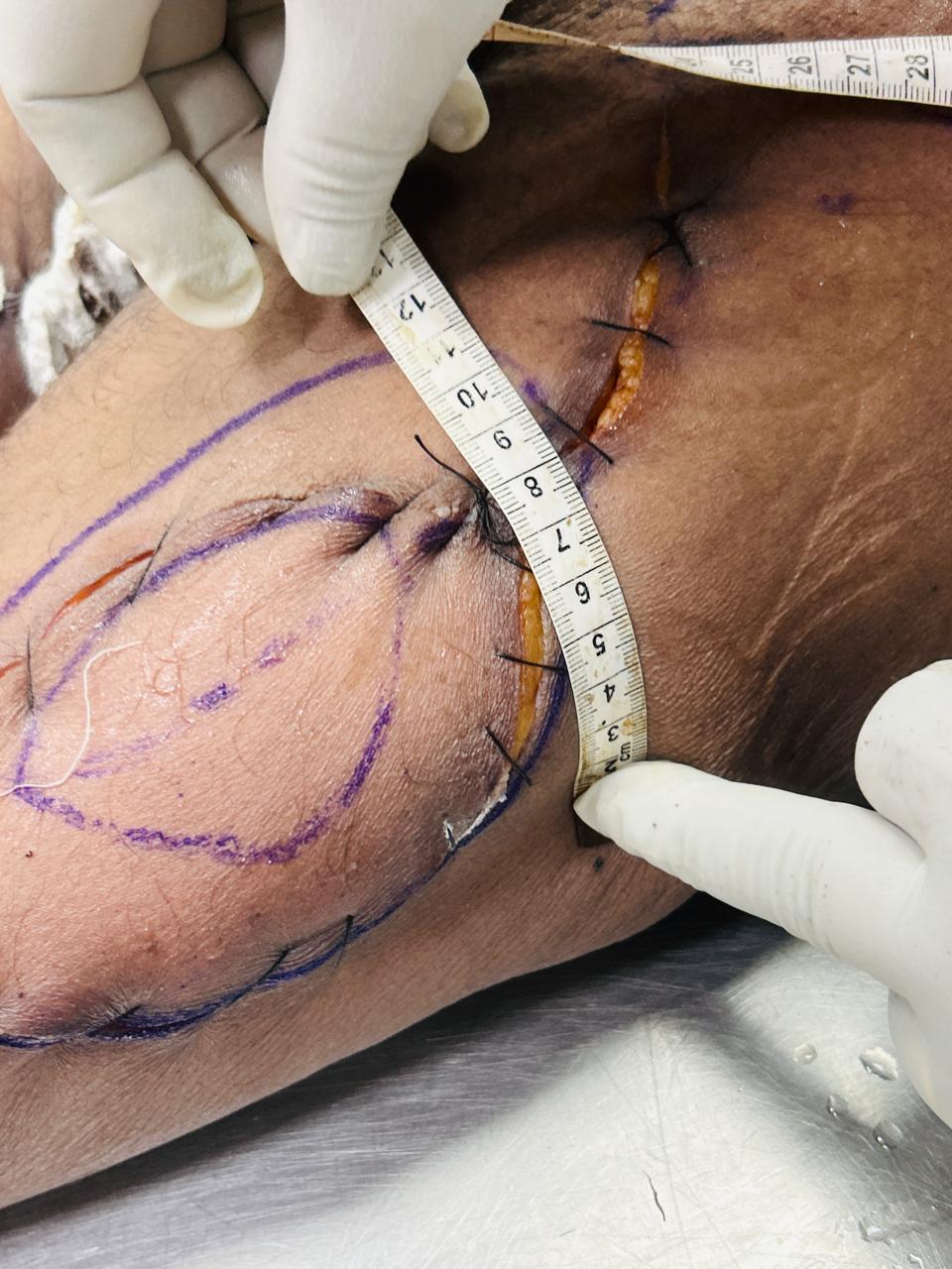 Scar Image