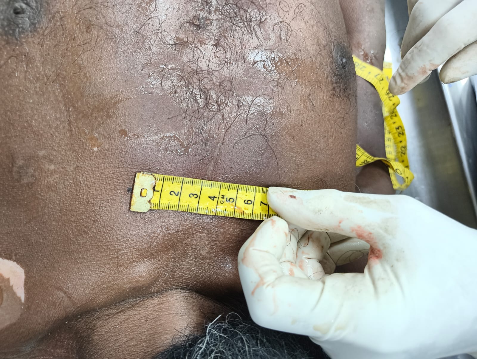 Scar Image