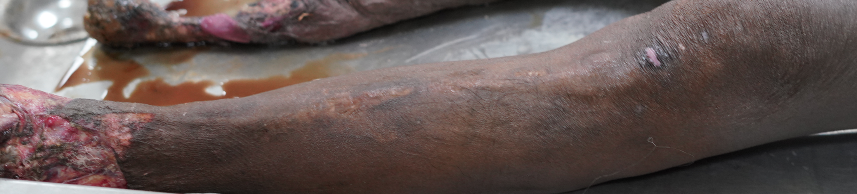Scar Image