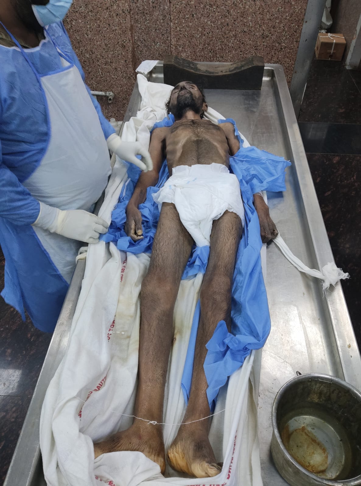 Scar Image