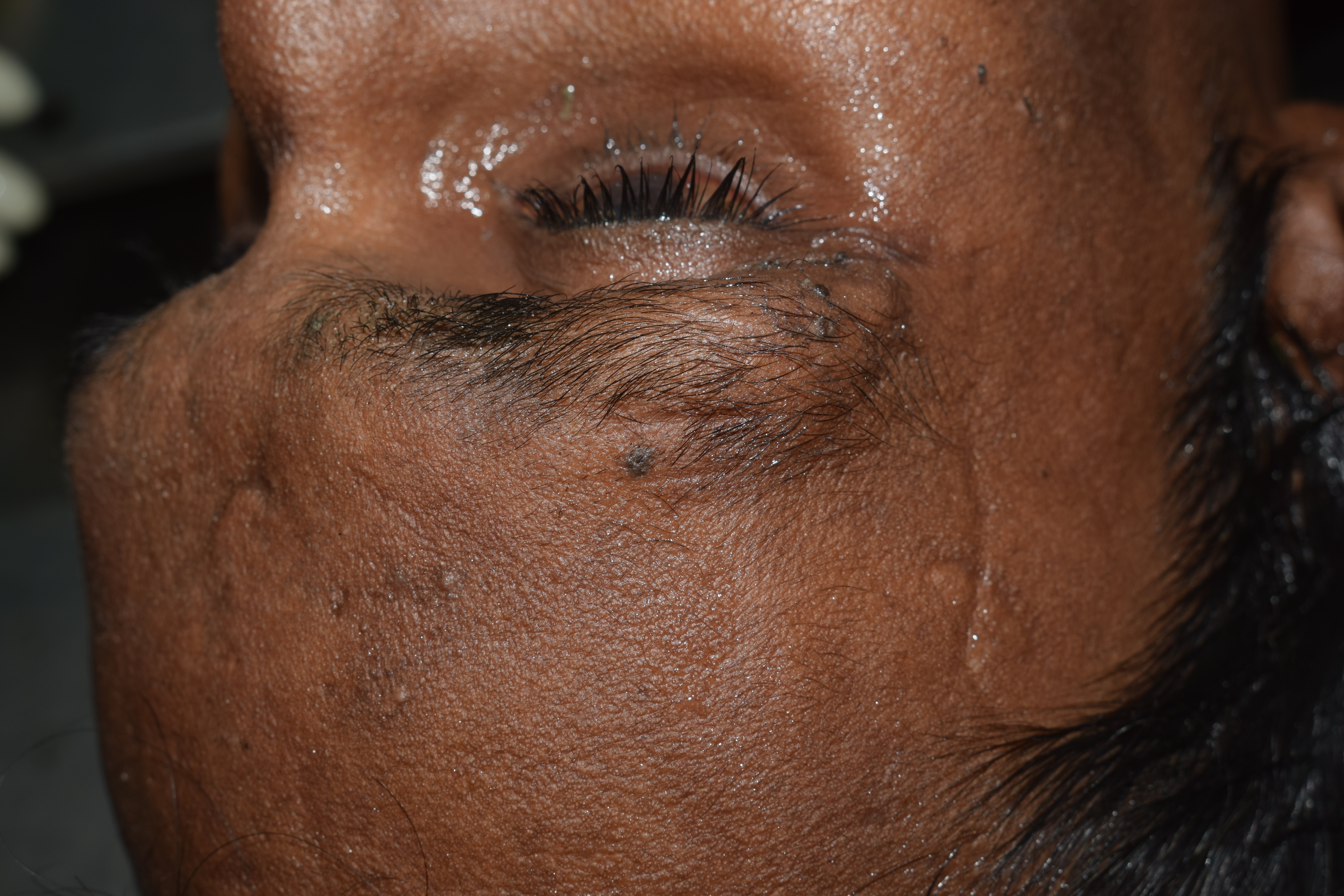 Scar Image