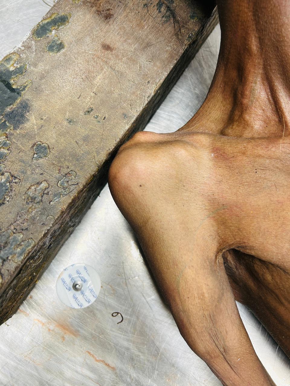 Scar Image
