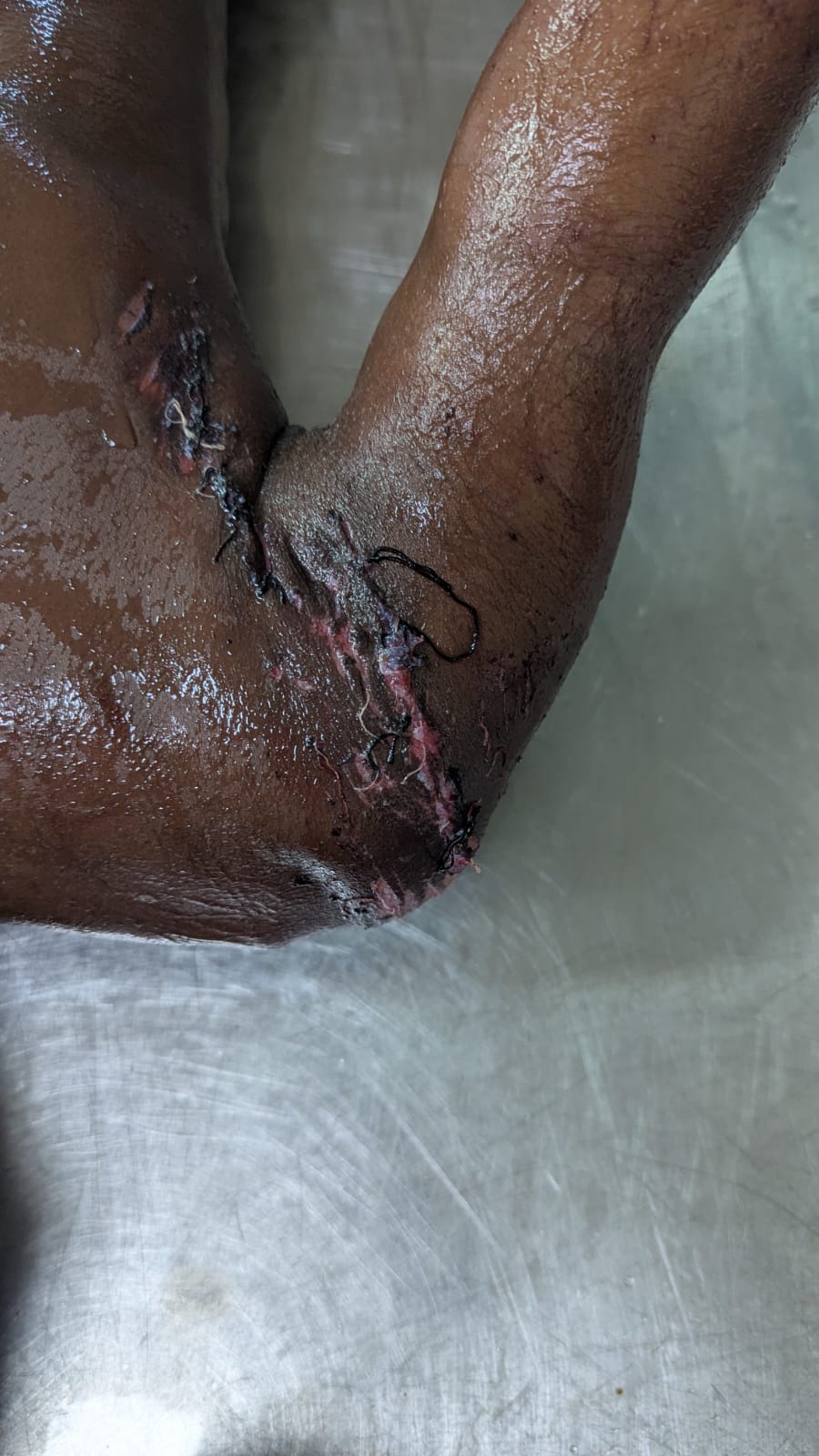 Scar Image