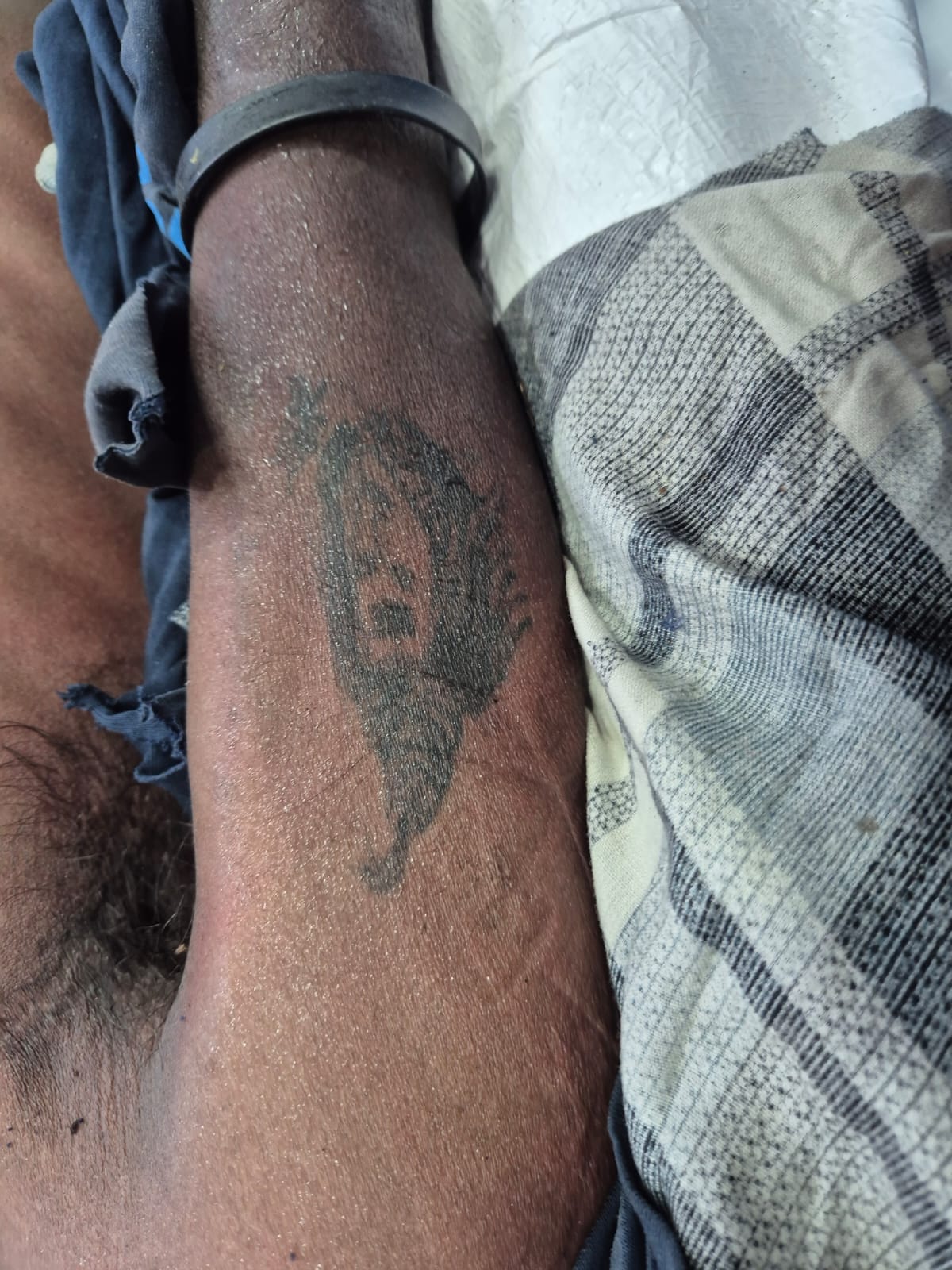 Scar Image