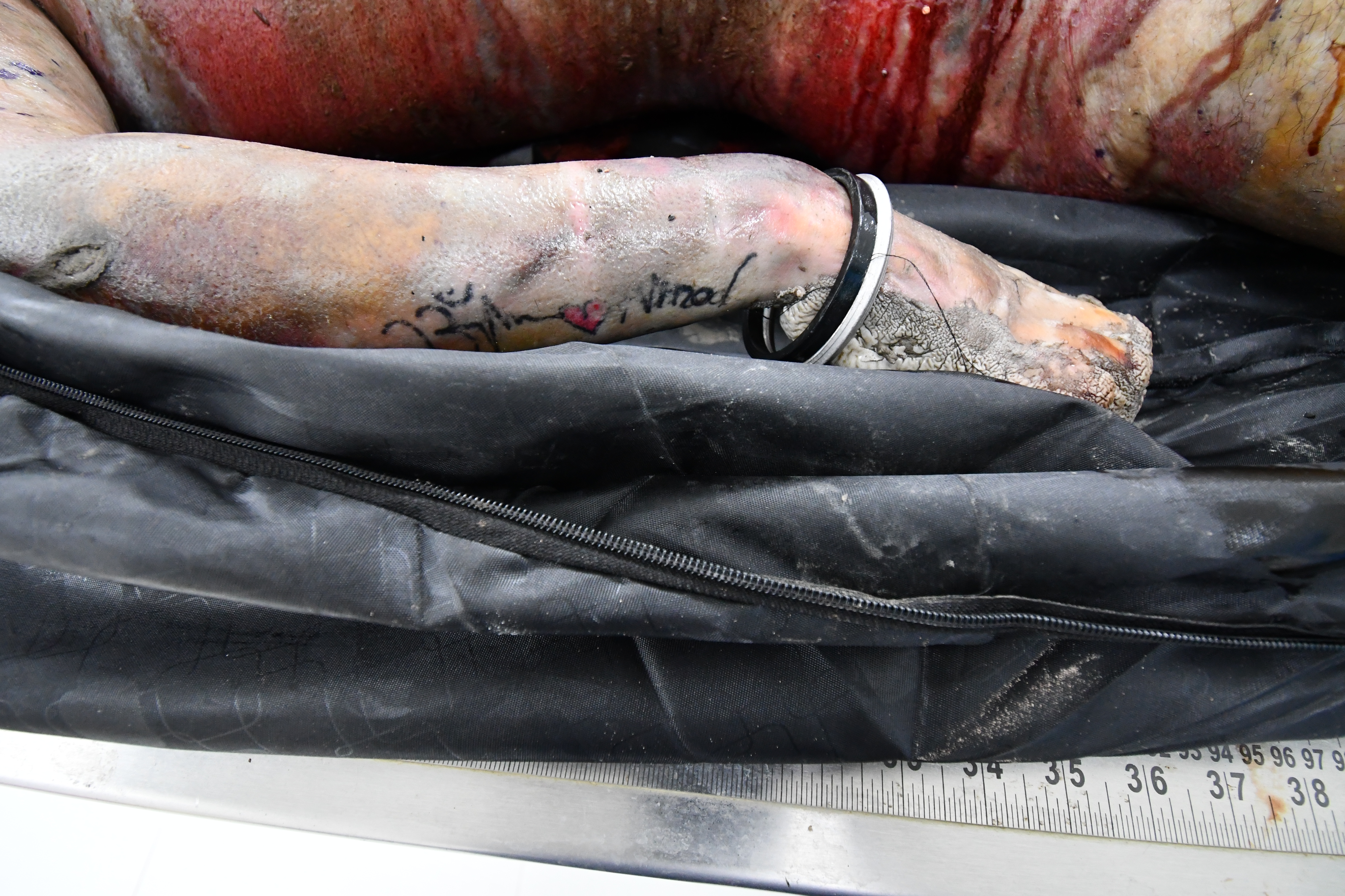 Scar Image