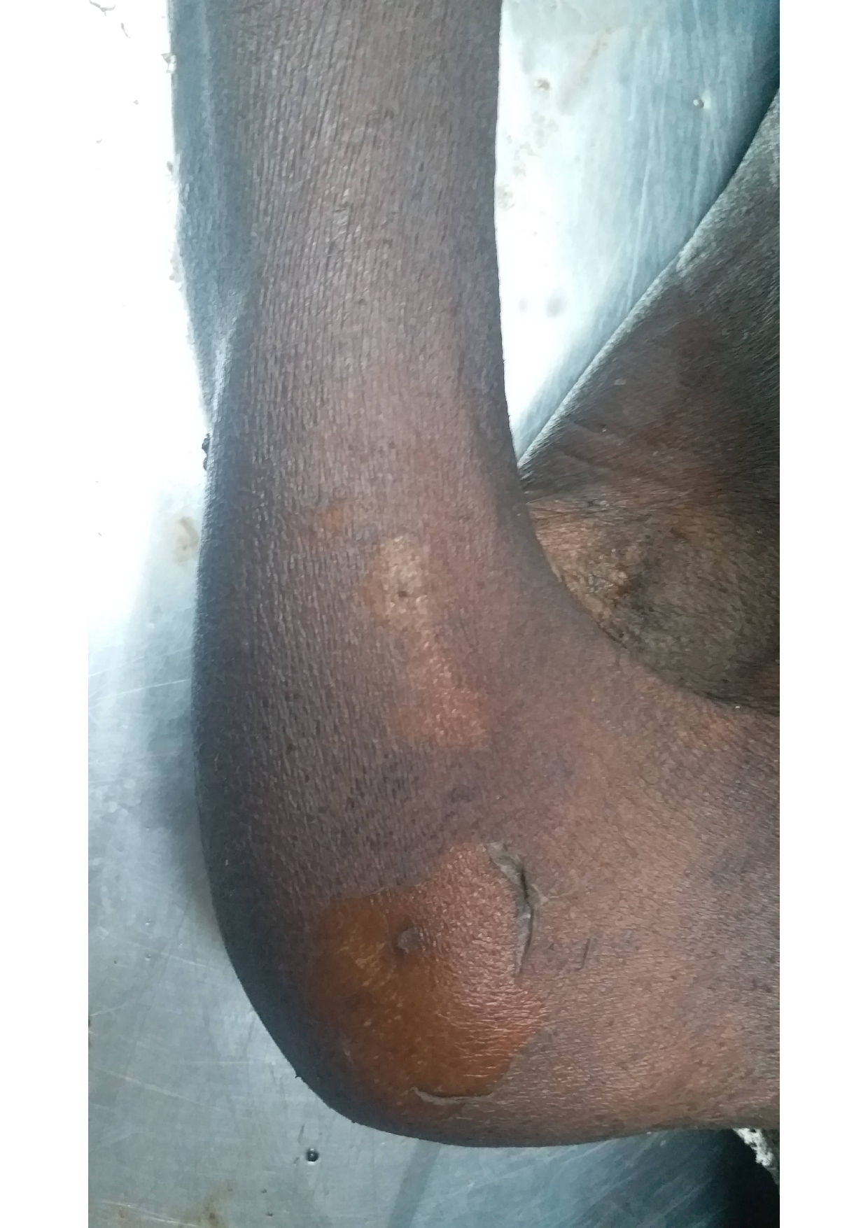 Scar Image