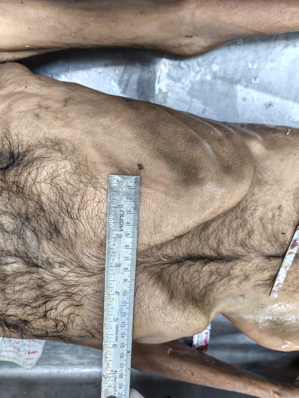 Scar Image