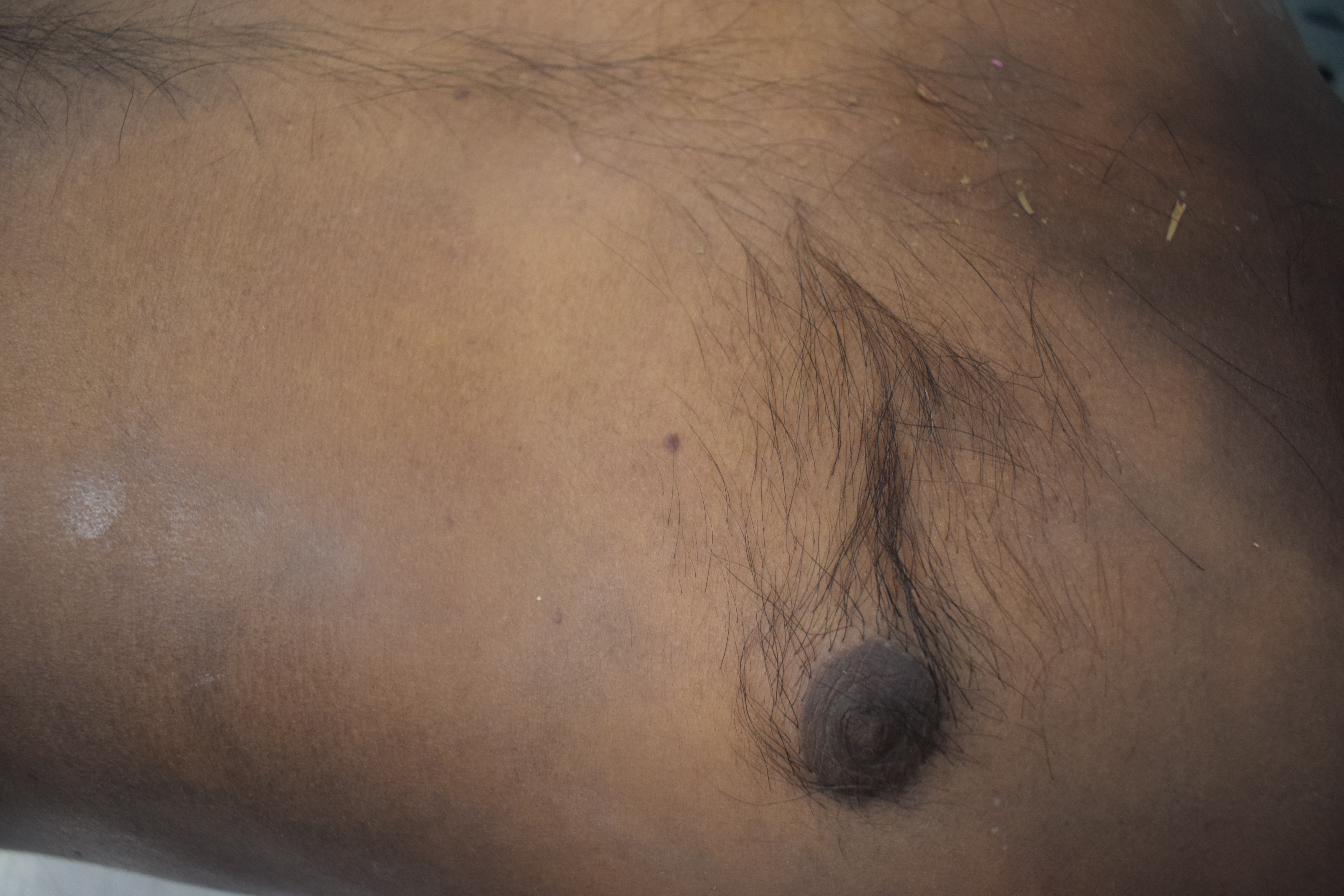 Scar Image