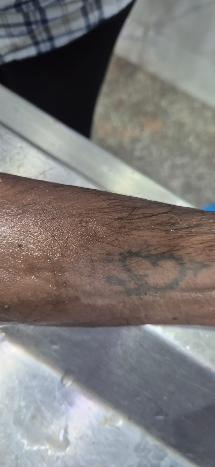 Scar Image