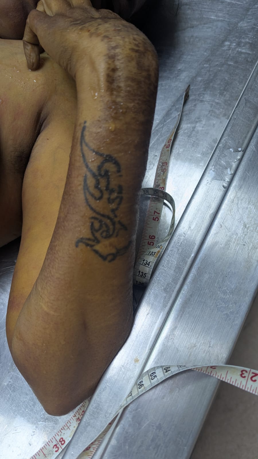 Scar Image