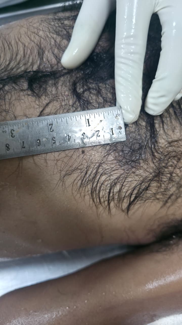 Scar Image