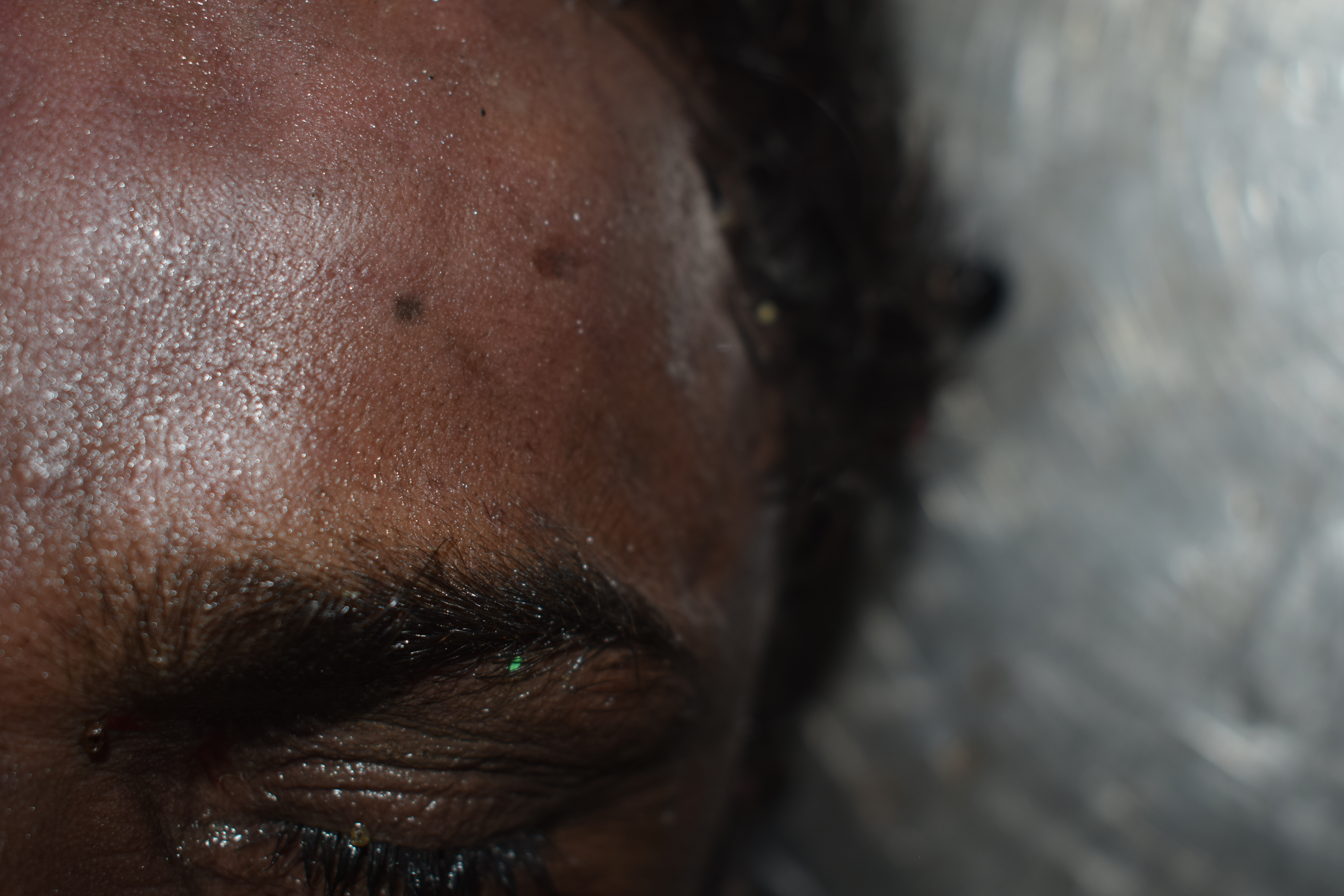 Scar Image