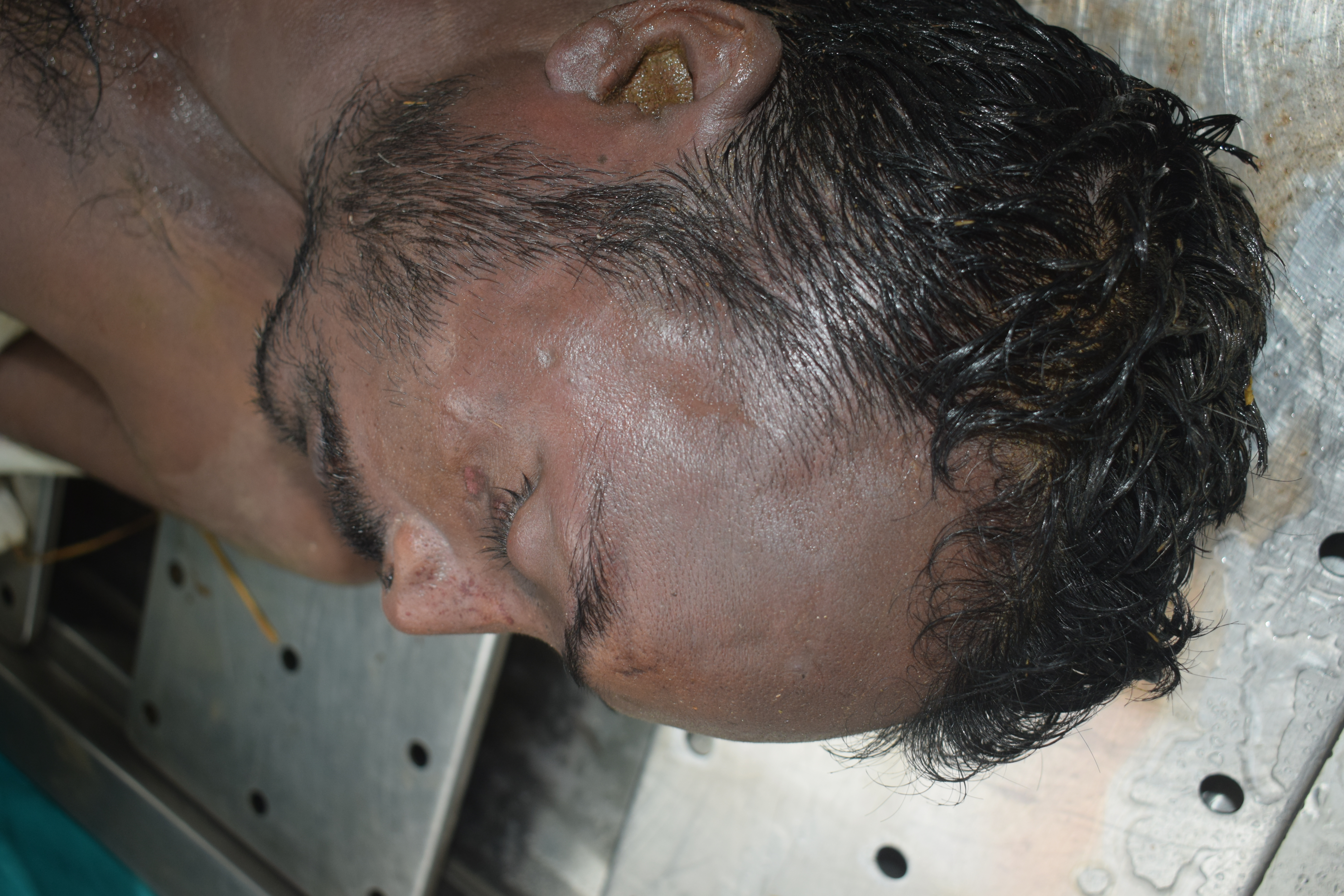 Scar Image
