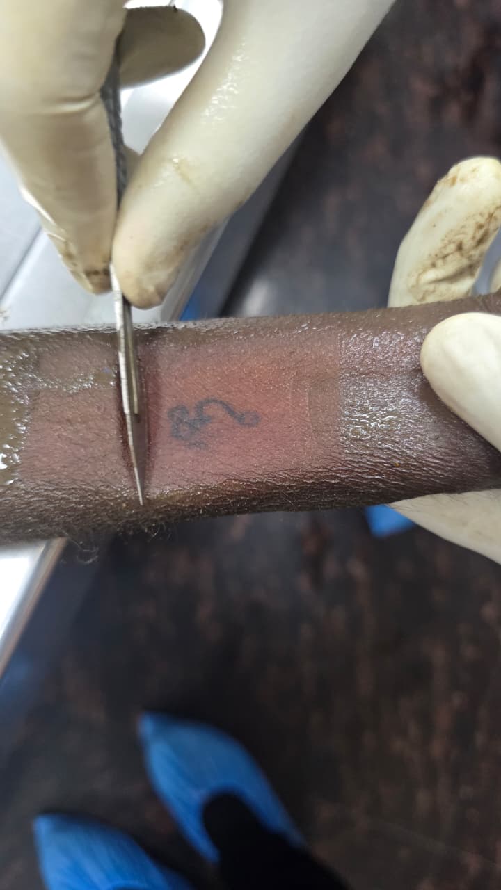 Scar Image