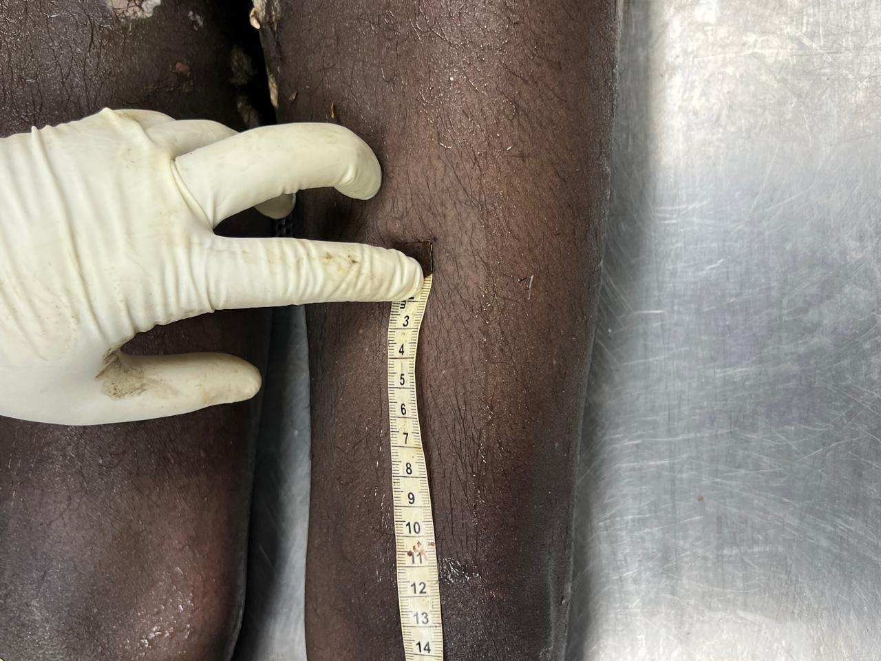 Scar Image