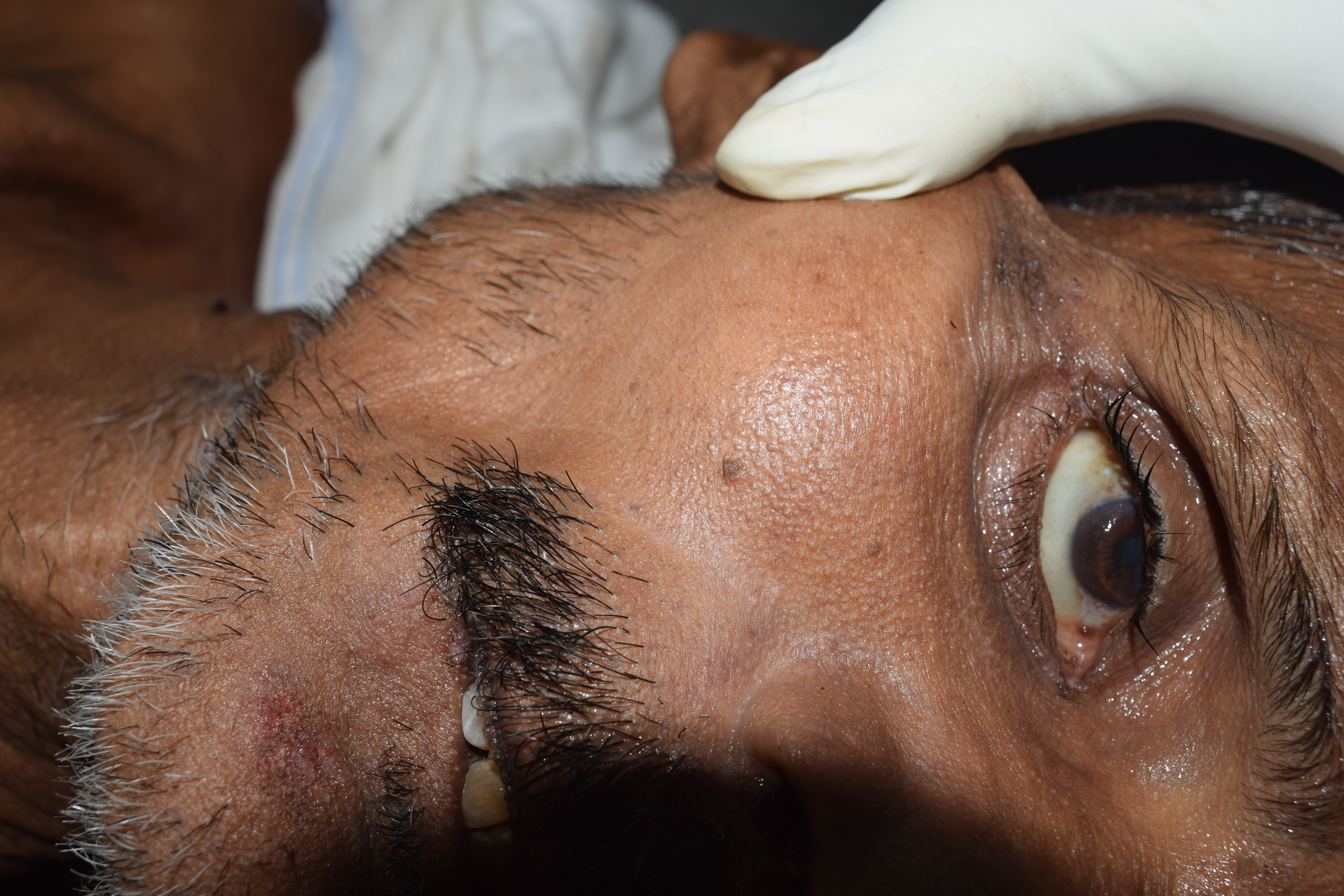Scar Image