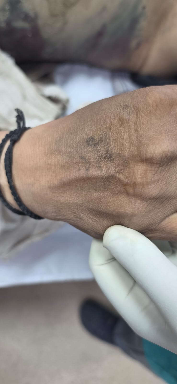 Scar Image