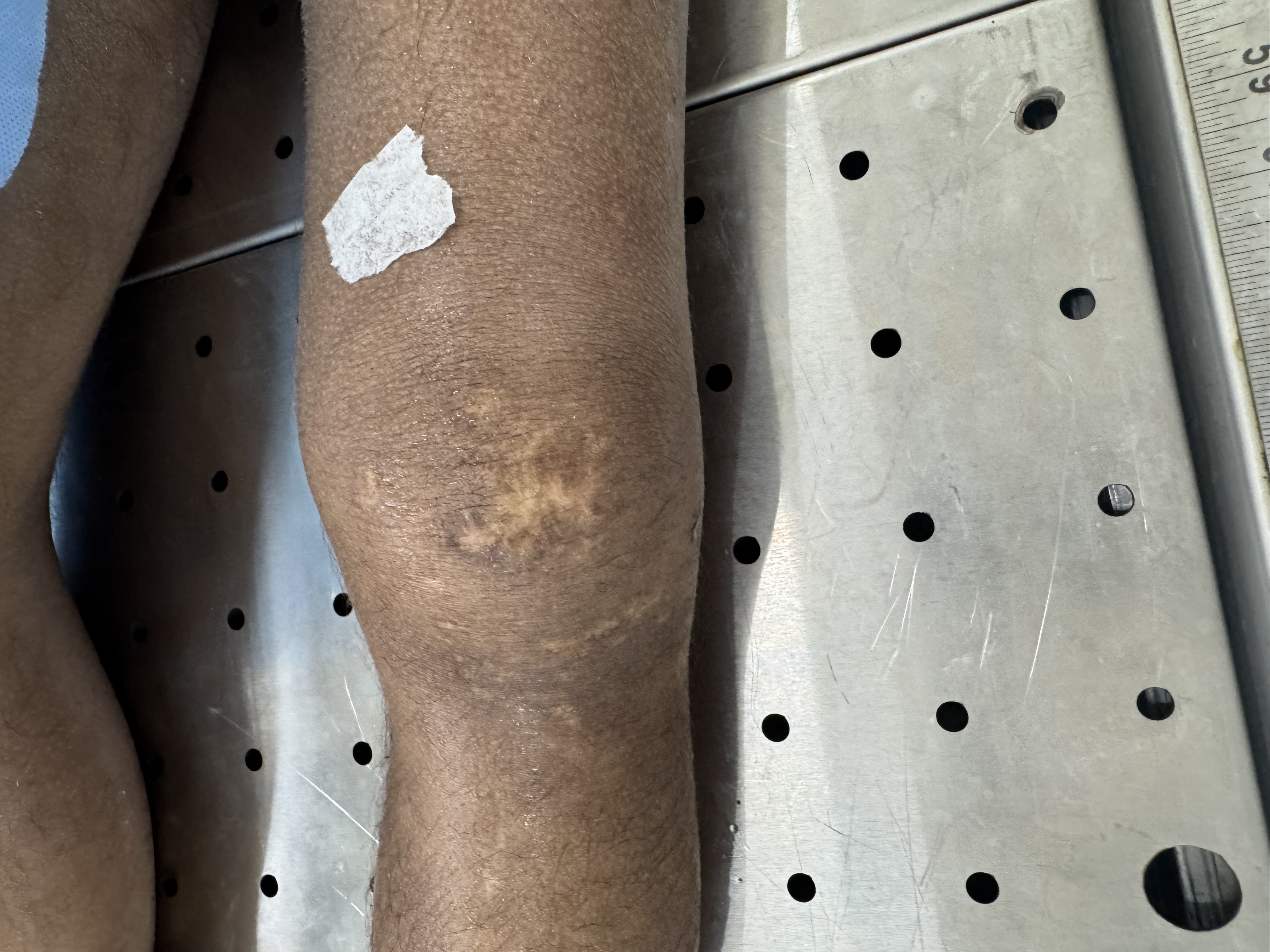 Scar Image
