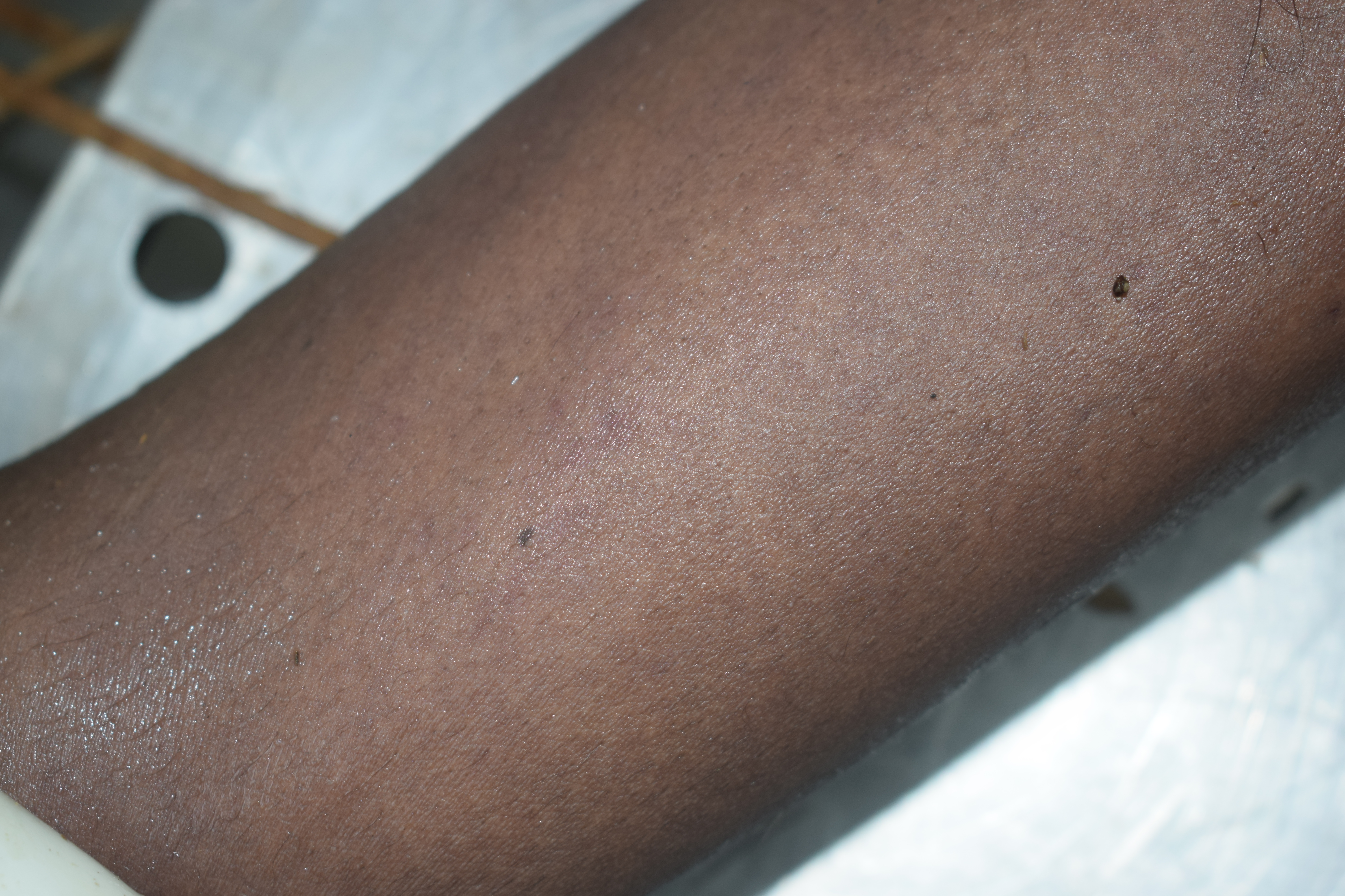 Tattoo Image